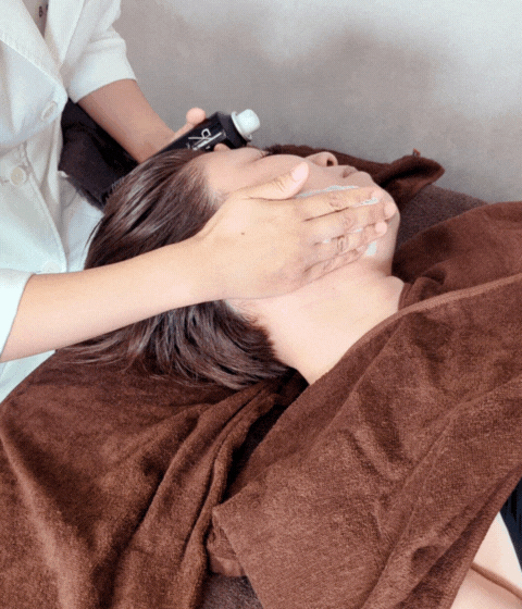 リフトアップの施術例